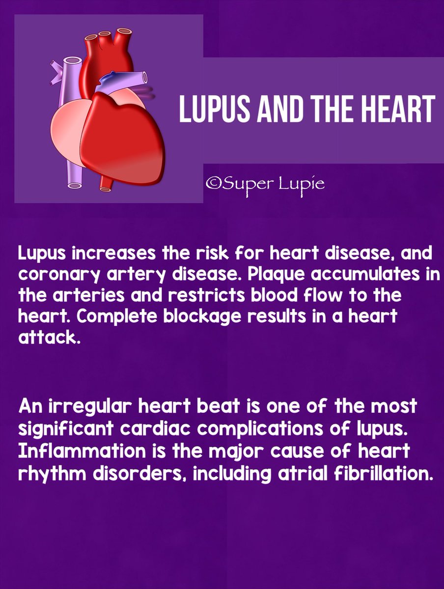 LupieSuper's tweet photo. https://t.co/1etuNdEAWP