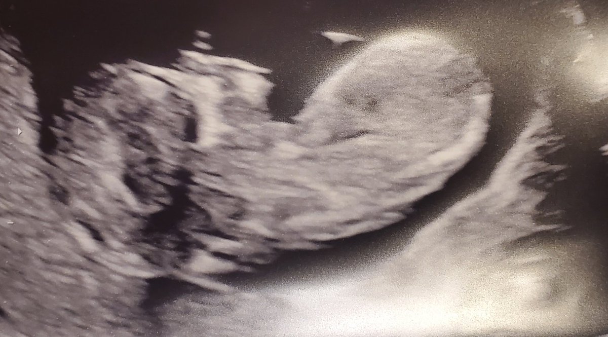 paperdeth's tweet image. We've been keeping a secret for a few months now. Baby due in July... LET'S GOOOOOO!!! 😊