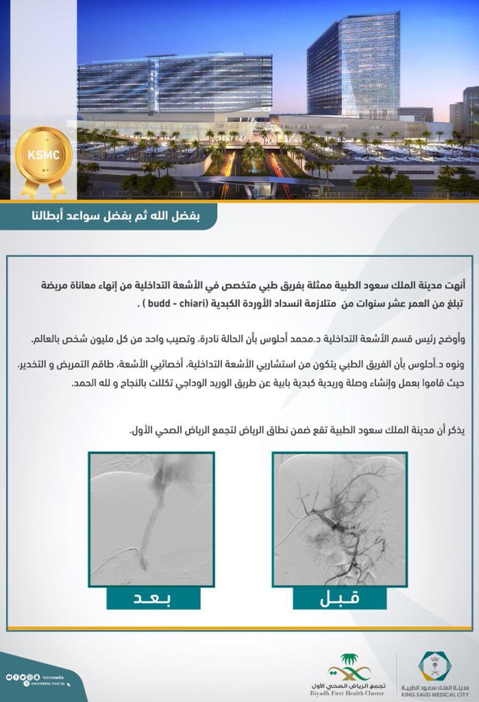 ksmcmedia's tweet image. 🤩 إنجازات سواعد أبطال #مدينة_الملك_سعود_الطبية مستمرة .