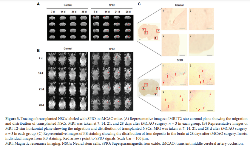AN_ASP_'s tweet photo. According to our studies, in vivo monitoring of transplanted NSCs during #ischemic stroke in the current work may provide another insight into the tracking strategy of transplanted #NSCs.
#Ischemic #stroke #Superparamagnetic
https://t.co/pfyBtD8k2n https://t.co/n1AKl7PbfB