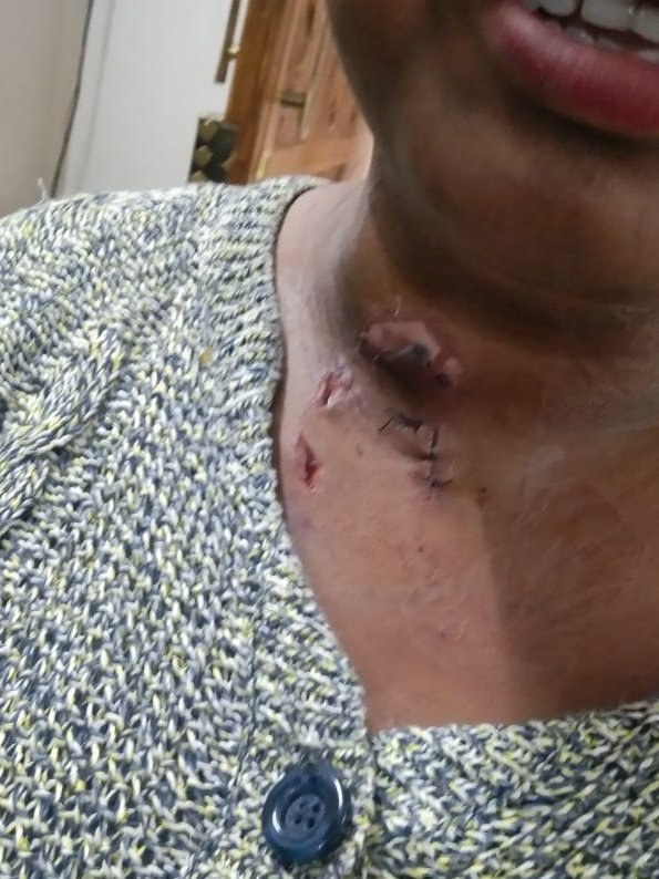 Connect_IFAT's tweet photo. Another day another attack on a @Uber woman driver. Priyanka Devi was brutally attacked by miscreants at Kashmere Gate Delhi @Connect_IFAT stands in solidarity with our Driver sister.
#JaagoUberJaago #DriverPowerUnionPower #DriverLivesMatter #IFATZindabad https://t.co/iMMyk9zMXd