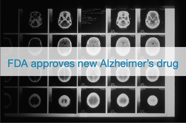 Great news for the Alzheimer’s space! 🎉 ….The FDA approves Alzheimer’s drug, Lecanemab, that slows cognitive decline for the US market. ✳ It is great news for Brain+, as our Digital Therapeutics products which also target the slowing down and prevention of cognitive decline!
