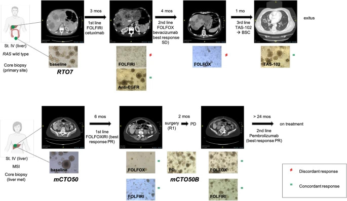 JournalofExper1's tweet photo. New study!🎯
Proteotranscriptomic analysis of advanced #colorectalcancer #patientderivedorganoids for #drugsensitivity prediction
Look here👇
https://t.co/8Fon5HE4el
#Quantitativeproteomics
#Precisionmedicine
#Drugresistance
@IREISGufficiale https://t.co/y8yeNsyGjp
