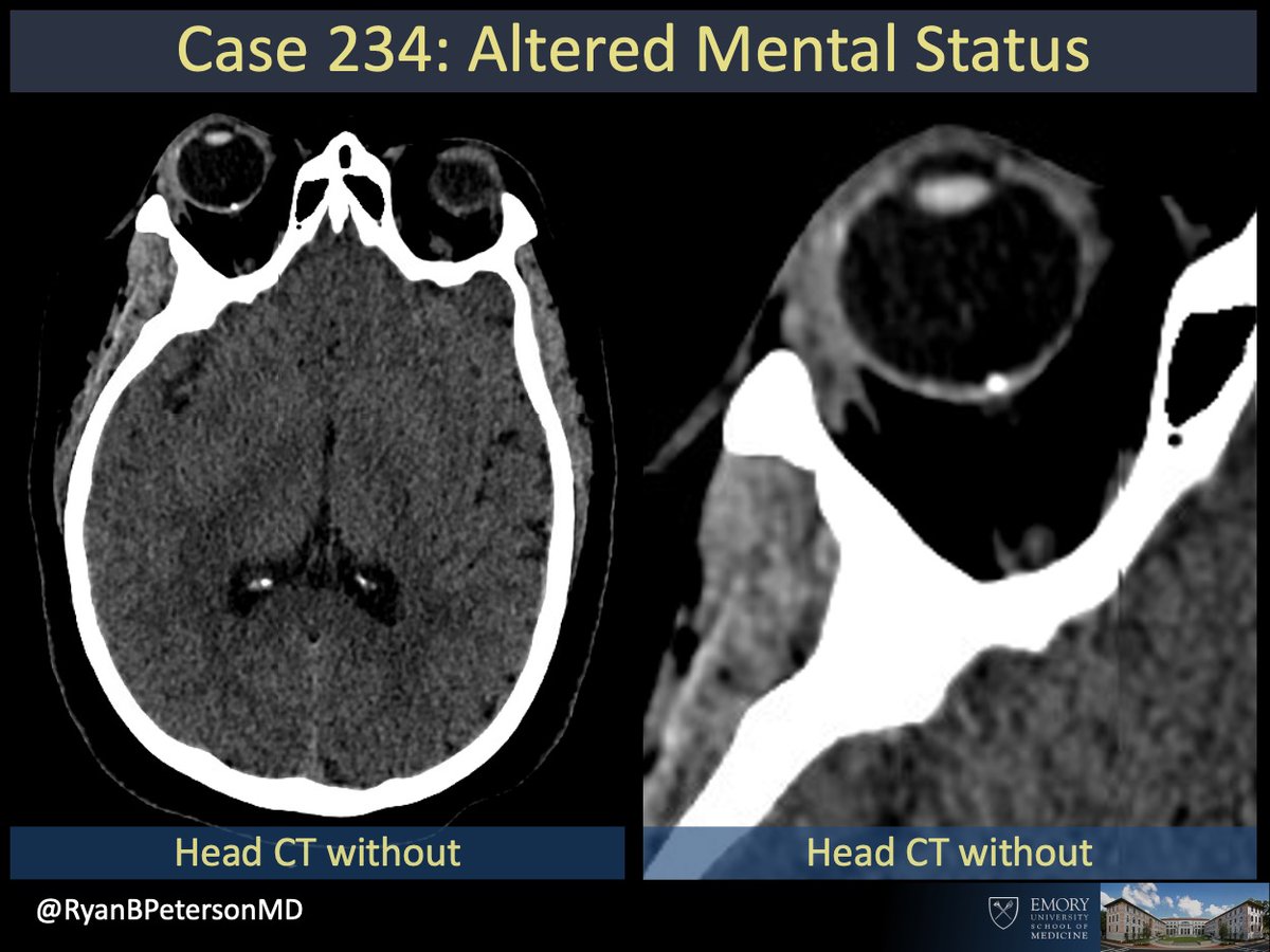 Ryan B Peterson 🇸🇪 tweet media