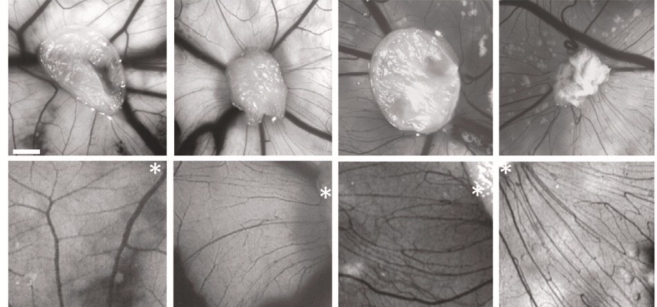 Estudo aponta relação entre #esquizofrenia e alterações vasculares no cérebro. Descrito em <a href="/molpsychiatry/">molecularpsychiatry</a>, o trabalho foi conduzido por grupos da <a href="/unicampoficial/">unicampoficial</a>, da <a href="/ufrj/">UFRJ</a> e do <a href="/Institutodor/">IDOR</a>. agencia.fapesp.br/40431/