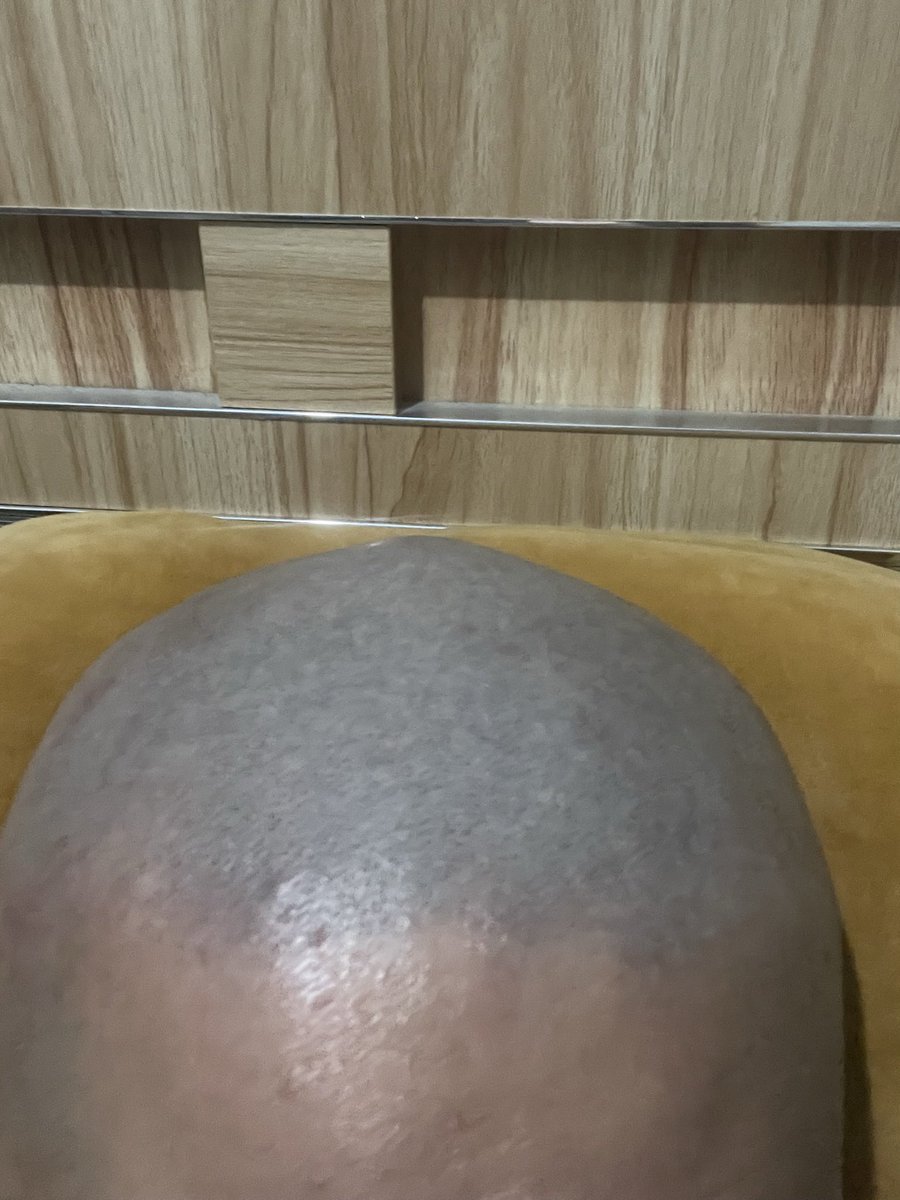 好久没有更新了 被催更了🫣
#莫西干 #寸头 #坊主 #光头 #光头犬 #剃头 #SHAVE