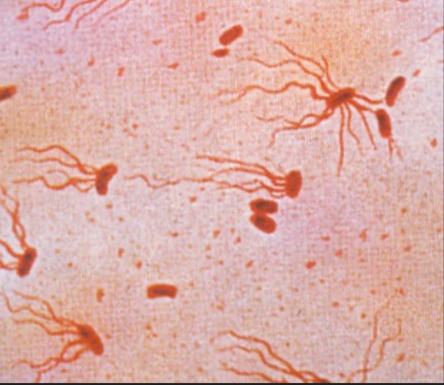 Jamie Louis, M.D. on Twitter "BrownHospMed Typhoid fever (enteric