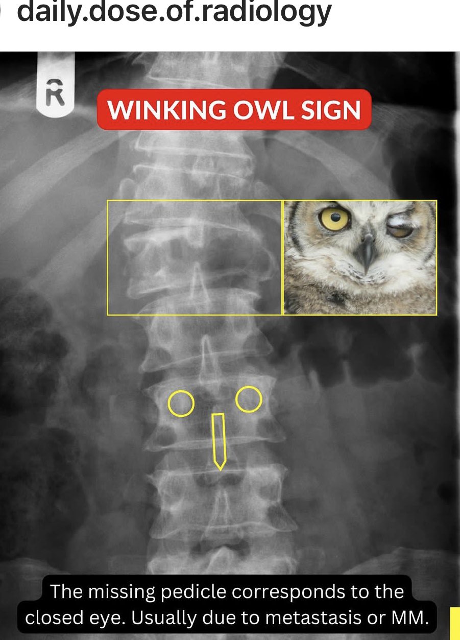 2025年最新】The Winking Owlの人気アイテム - メルカリ