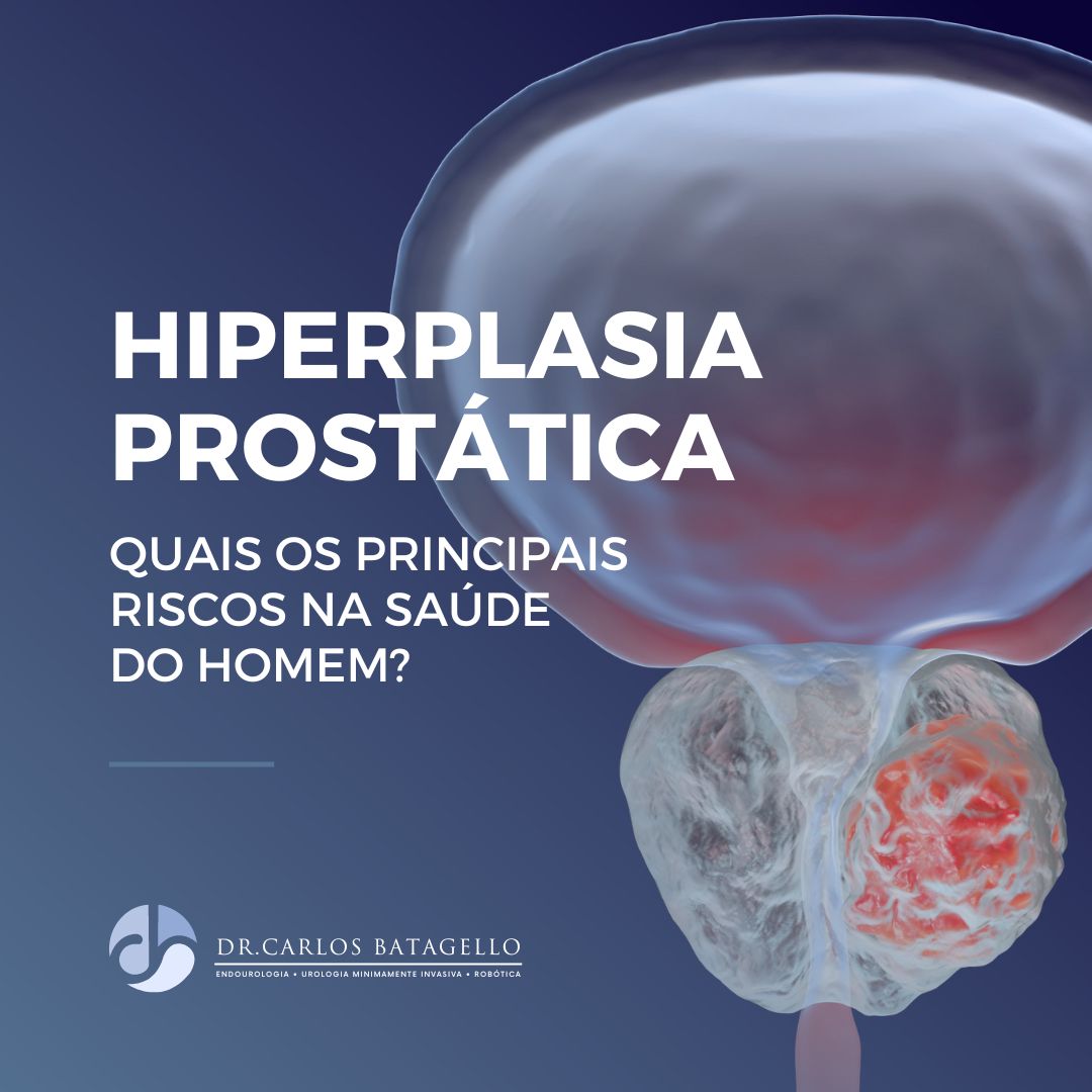 A hiperplasia prostática benigna, comumente chamada de HPB, é o aumento benigno da glândula prostática, ou seja, não é um câncer.

Leia tudo sobre: carlosbatagello.com.br/hiperplasia-pr…

#hiperplasiaprostatica