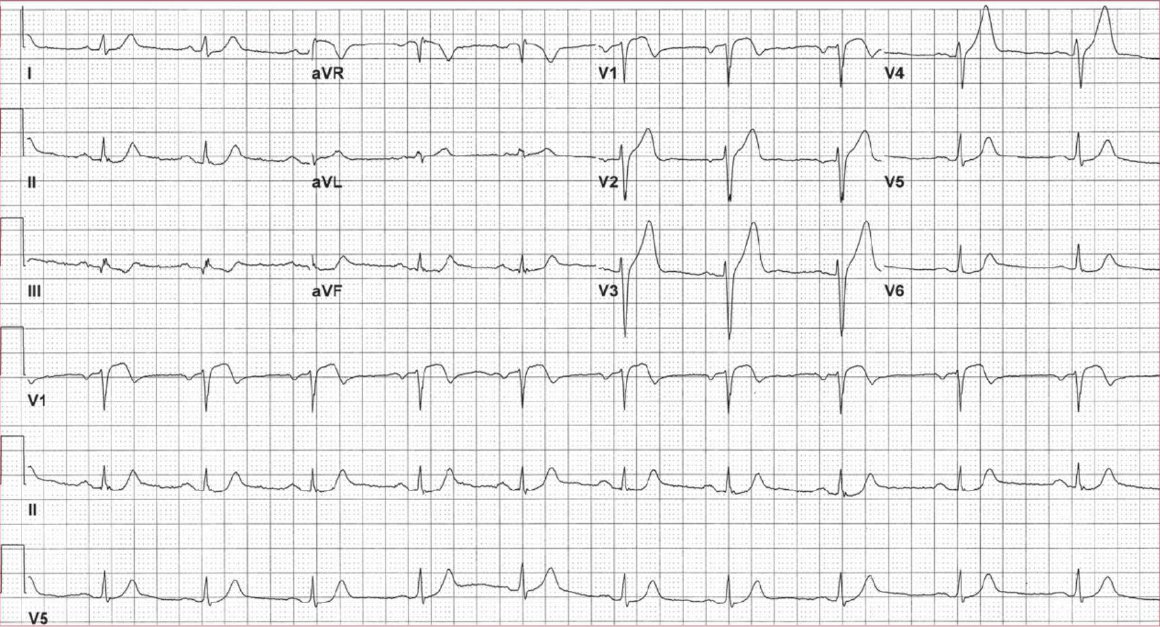 Manual Of Medicine on Twitter "A 63yearold woman presents with the acute onset of chest
