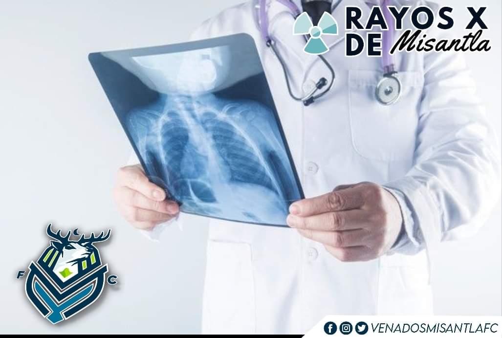 #Venado, ¿necesitas radiografía portatil? 🩻🦌

Contacta a #RayosXMisantla y conoce todos sus servicios de radiología de alta calidad, estudios confiables y precios accesibles. 💚

📞 2351008196

Patrocinador oficial de 🦌 #VenadosMisantla #SomosVenados #JuntosEnManada  ⚽