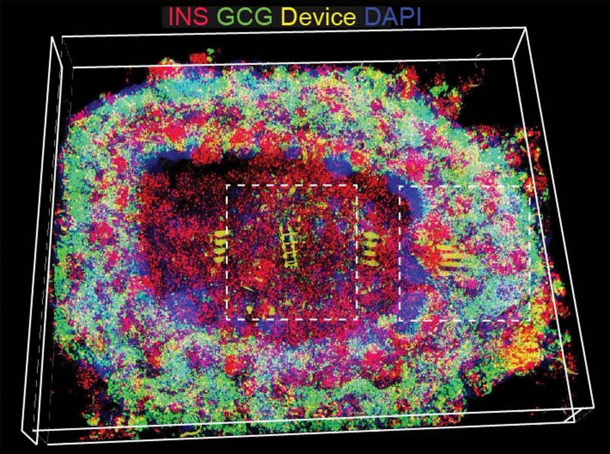 Juan Alvarez (@juanalvarezdom) on Twitter photo Please RT: Hiring postdoc for exciting projects on next-generation organoids👇<a href="/PennIDOM/">Penn IDOM</a> <a href="/chronosleepinst/">Penn_ChronoSleepInst</a> <a href="/IRM_UPenn/">Institute for Regenerative Medicine</a> <a href="/PennCDB/">UPenn CDB</a> <a href="/PennMedicine/">Penn Medicine</a>. We make islet organoids for basic research and diabetes regenerative medicine. Tell your grad student / reach out with CV + references! Please RT: Hiring postdoc for exciting projects on next-generation organoids👇<a href="/PennIDOM/">Penn IDOM</a> <a href="/chronosleepinst/">Penn_ChronoSleepInst</a> <a href="/IRM_UPenn/">Institute for Regenerative Medicine</a> <a href="/PennCDB/">UPenn CDB</a> <a href="/PennMedicine/">Penn Medicine</a>. We make islet organoids for basic research and diabetes regenerative medicine. Tell your grad student / reach out with CV + references!