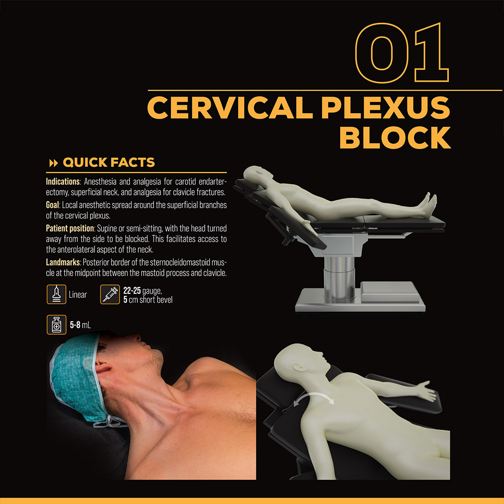 NYSORA's tweet photo. Here's another page from the #NerveBlock Manual, sharing the look and feel of this stunningly illustrated guidebook. These are our quick facts on the #CervicalPlexus block.

Purchase your little black book of #regionalanesthesia today https://t.co/EzwUDE107K https://t.co/kwPq2eA9uD
