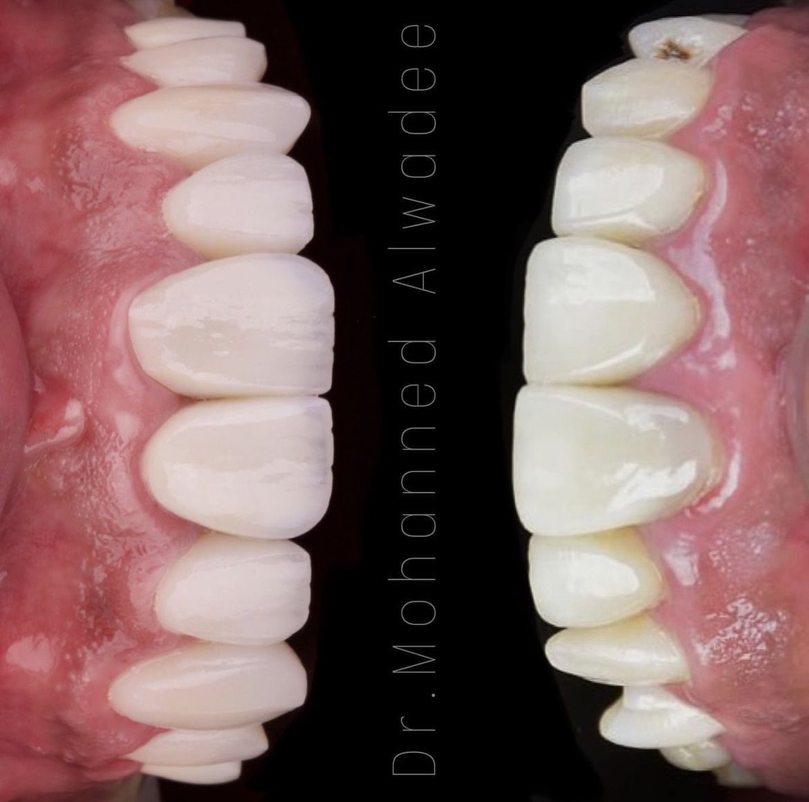 Keep it natural .. 

🦷 by: <a href="/dr/">Dan Rowden</a>.mohannedjr