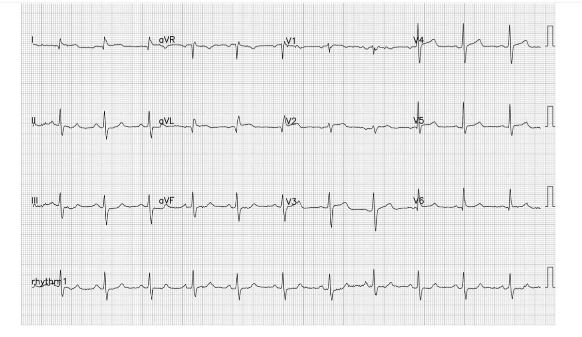 Kevin Butler tweet media