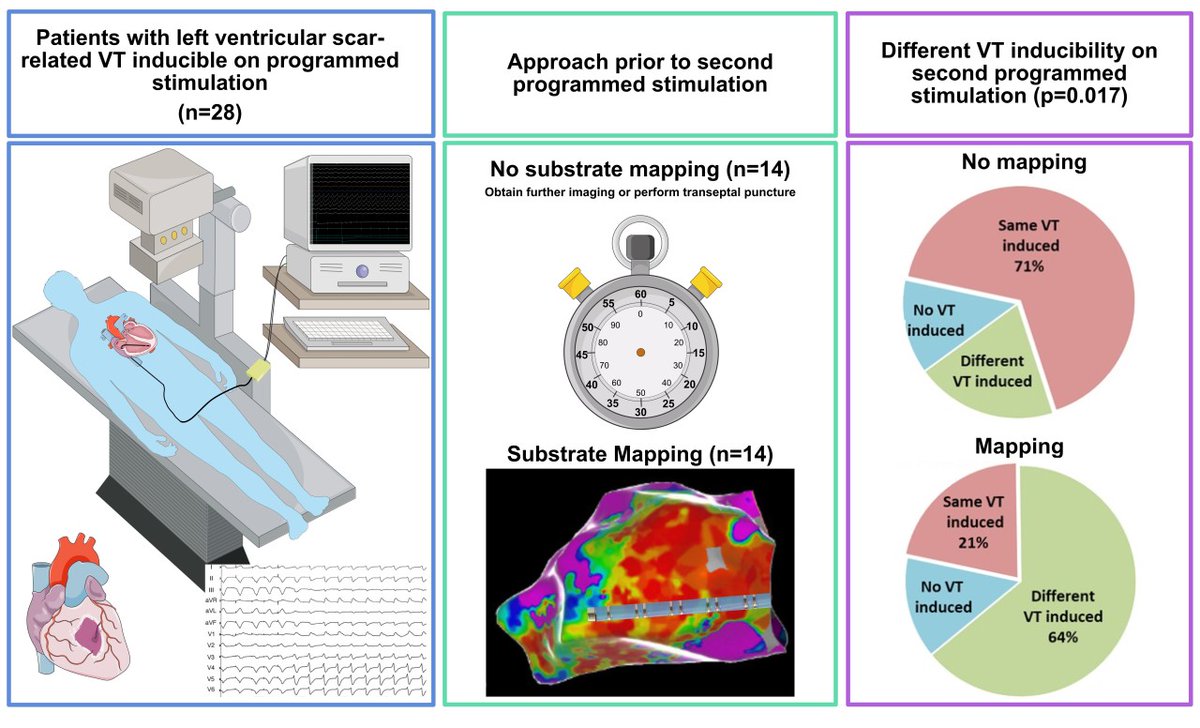 CircEP (@circulationep) on Twitter photo Substrate Mapping Alters Ventricular Tachycardia Inducibility <a href="/ArvindhKana/">Arvindh Kanagasundram</a> #AHAJournals #Epeeps ahajrnls.org/3GDWA0q Substrate Mapping Alters Ventricular Tachycardia Inducibility <a href="/ArvindhKana/">Arvindh Kanagasundram</a> #AHAJournals #Epeeps ahajrnls.org/3GDWA0q