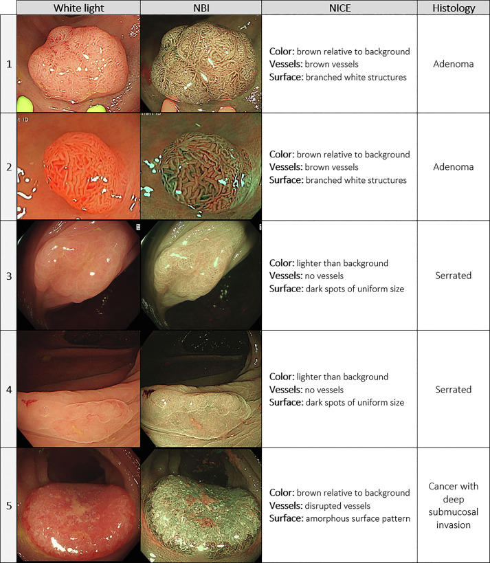 ASGE GI Endoscopy tweet media