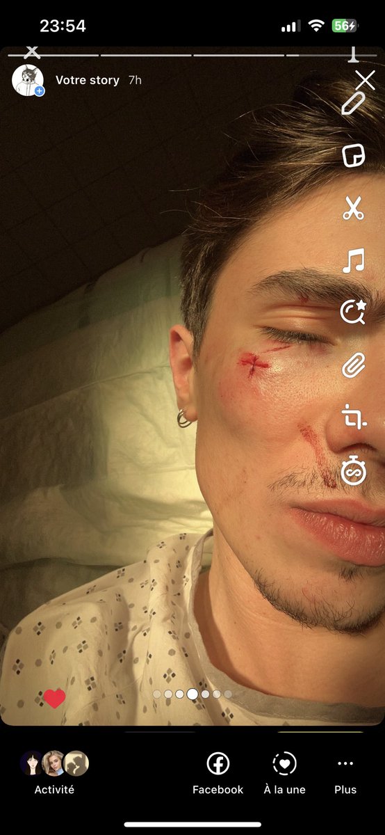 PabloFe26337792's tweet photo. Bonjour , thread assez rapide contre l’ayers rock à Lyon pour non assistance à personne en danger et pour coup et blessure sur ma personne , je vous invite à partager et à lire pour fermer ce genre d’établissement qui ne devrait plus être …
 Merci  #Lyon  #ayersrock #bagarre https://t.co/ZekyMhqEG4