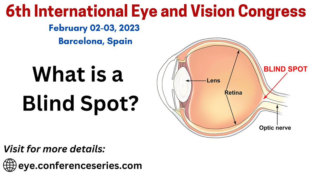 EdinaStephen's tweet image. Because there are no #lightsensitive cells, such as rods and cones, at the #intersection of the #optic #nerve and #retina in the #eye, vision is not possible there. It is known as a #blind #area. Thus, we can define a blind spot as light-#insensitive.