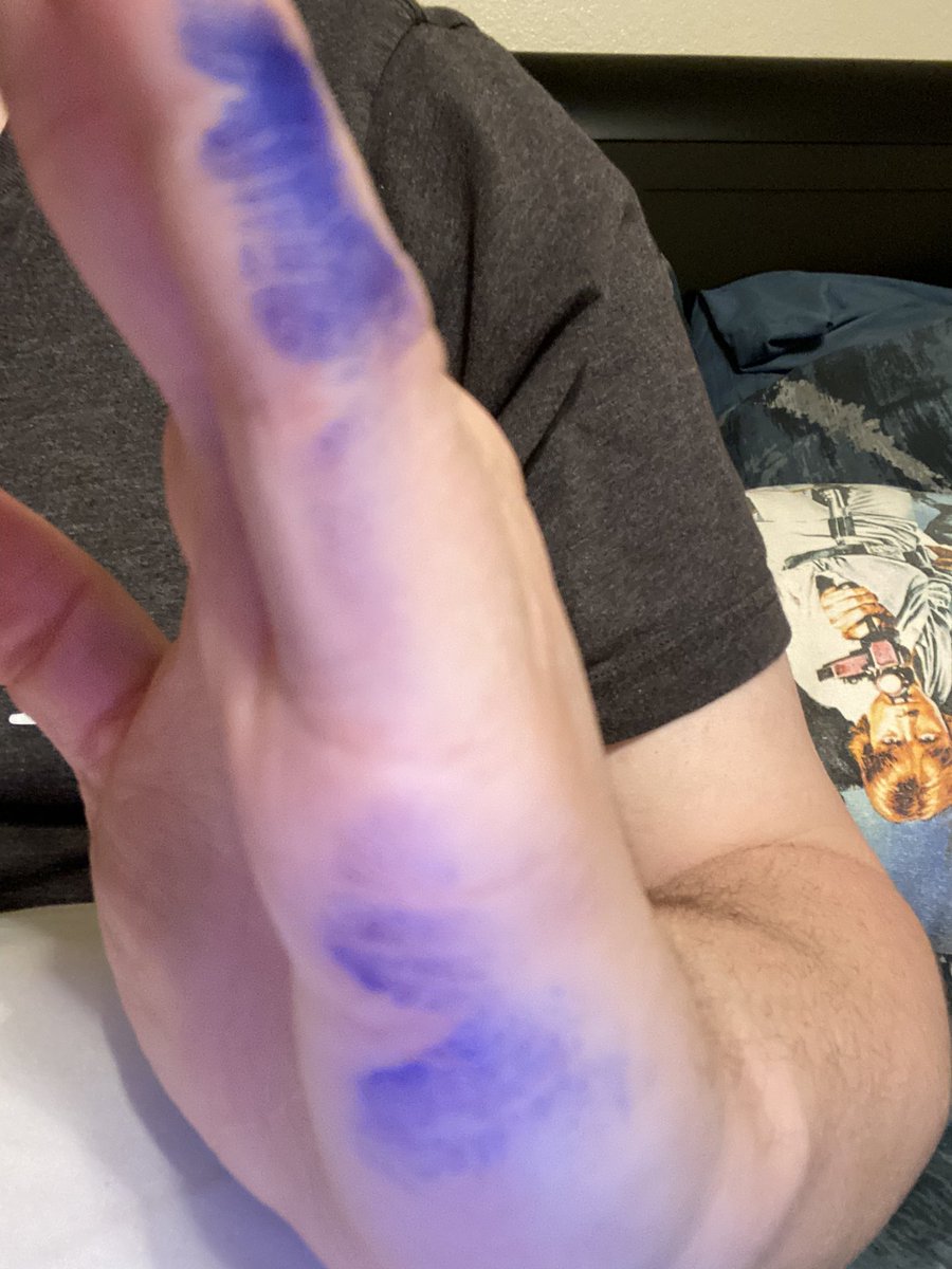 _TJ_Rigg's tweet photo. #LeftyProbs https://t.co/941KlkQubm
