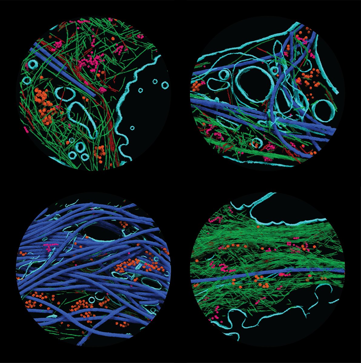 Jess Heebner (@parameciumbrain) on Twitter photo Come see my AI generated art at #bps2023! Multi-class UNet segmentaion of hippocampal neurons. Excited to be chosen as a finalist in the BPS2023 art contest! <a href="/SwuliusLab/">SwuliusLab</a> @OrsDragonfly3D Come see my AI generated art at #bps2023! Multi-class UNet segmentaion of hippocampal neurons. Excited to be chosen as a finalist in the BPS2023 art contest! <a href="/SwuliusLab/">SwuliusLab</a> @OrsDragonfly3D