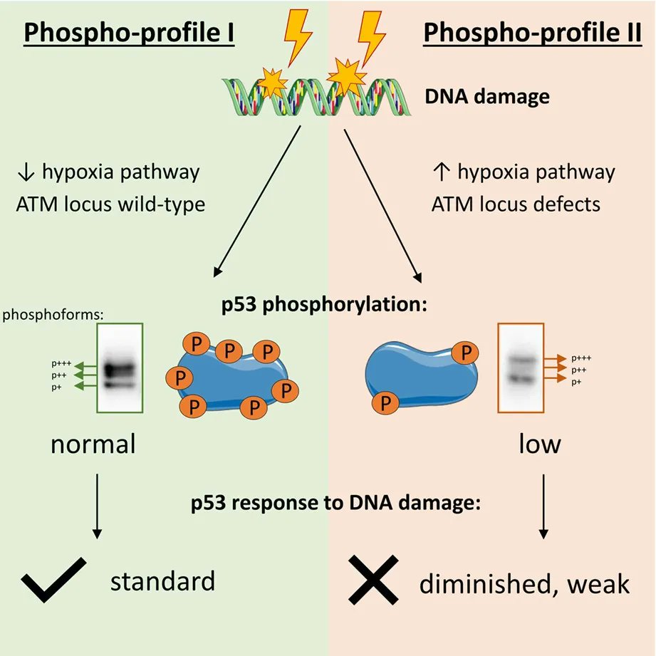 MolOncology's tweet photo. Distinct p53 phosphorylation patterns in chronic lymphocytic leukemia patients are reflected in the activation of circumjacent pathways upon DNA damage
🖱️https://t.co/F6xkggj5Pu
#CLL #LYLSM #TP53
#Phosphorylation #DoubleStrandBreak
@petr_taus @KarlaPlevova https://t.co/n4zCxrK4HH