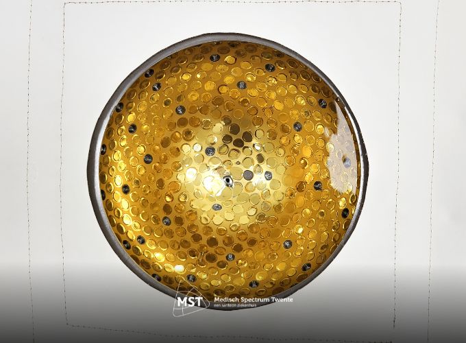 Het ziet er #futuristisch uit: de behandeltafel met een gouden ronde uitsparing waar water in zit. Vervangt deze goud lijkende discobal in de toekomst de mammografie? 🔗linkedin.com/pulse/borstkan…