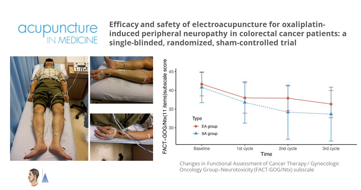 🔀Essai contrôlé randomisé 🇭🇰
📰Acupunct Med (IF 2.2)
Neuropathie induite par oxaliplatine pour cancer colorectal. Efficacité de l’acupuncture [A] 𝑣𝑒𝑟𝑠𝑢𝑠 fausse [A]. ↘ Sévérité [échelle de neurotoxicité FACT/GOG-Ntx], ↗ qualité de vie [QLQ-C30].

pubmed.ncbi.nlm.nih.gov/36325677🔓