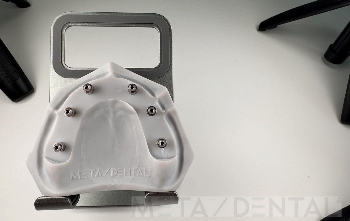 MetaDentalDE's tweet photo. #meta-dental
#implant
#allon6
#zirconia https://t.co/99ODgQP9IC