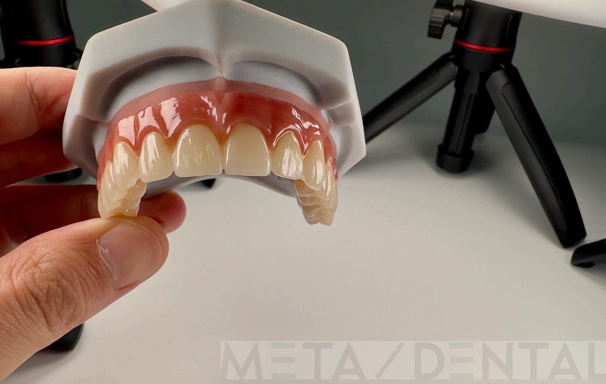 MetaDentalDE's tweet photo. #meta-dental
#implant
#allon6
#zirconia https://t.co/99ODgQP9IC