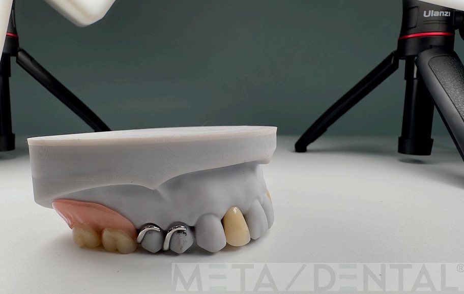 MetaDentalDE's tweet photo. #meta-dental
#ccpworks
#ivolcar https://t.co/ZmXnj17tk7