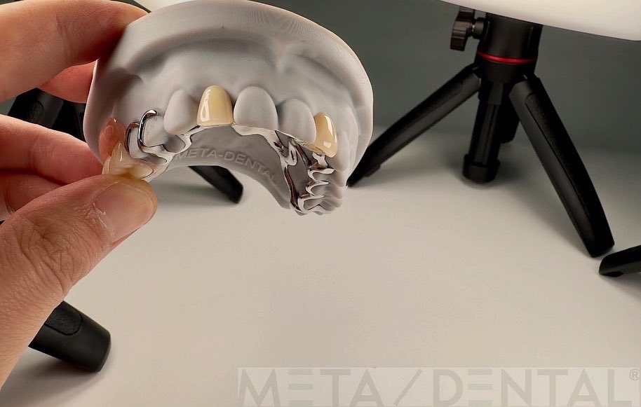 MetaDentalDE's tweet photo. #meta-dental
#ccpworks
#ivolcar https://t.co/ZmXnj17tk7
