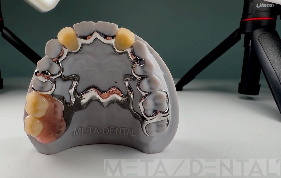 MetaDentalDE's tweet photo. #meta-dental
#ccpworks
#ivolcar https://t.co/ZmXnj17tk7