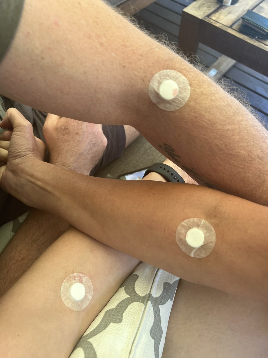 LifeByEight's tweet photo. Testing IV Drips with professionals who come to your home. An incredible experience with very noticeable results 👌

#ivdrip #iv #health #vitamins #lifebyeight #biohacking #brisbane https://t.co/cW0FCxkWZ6
