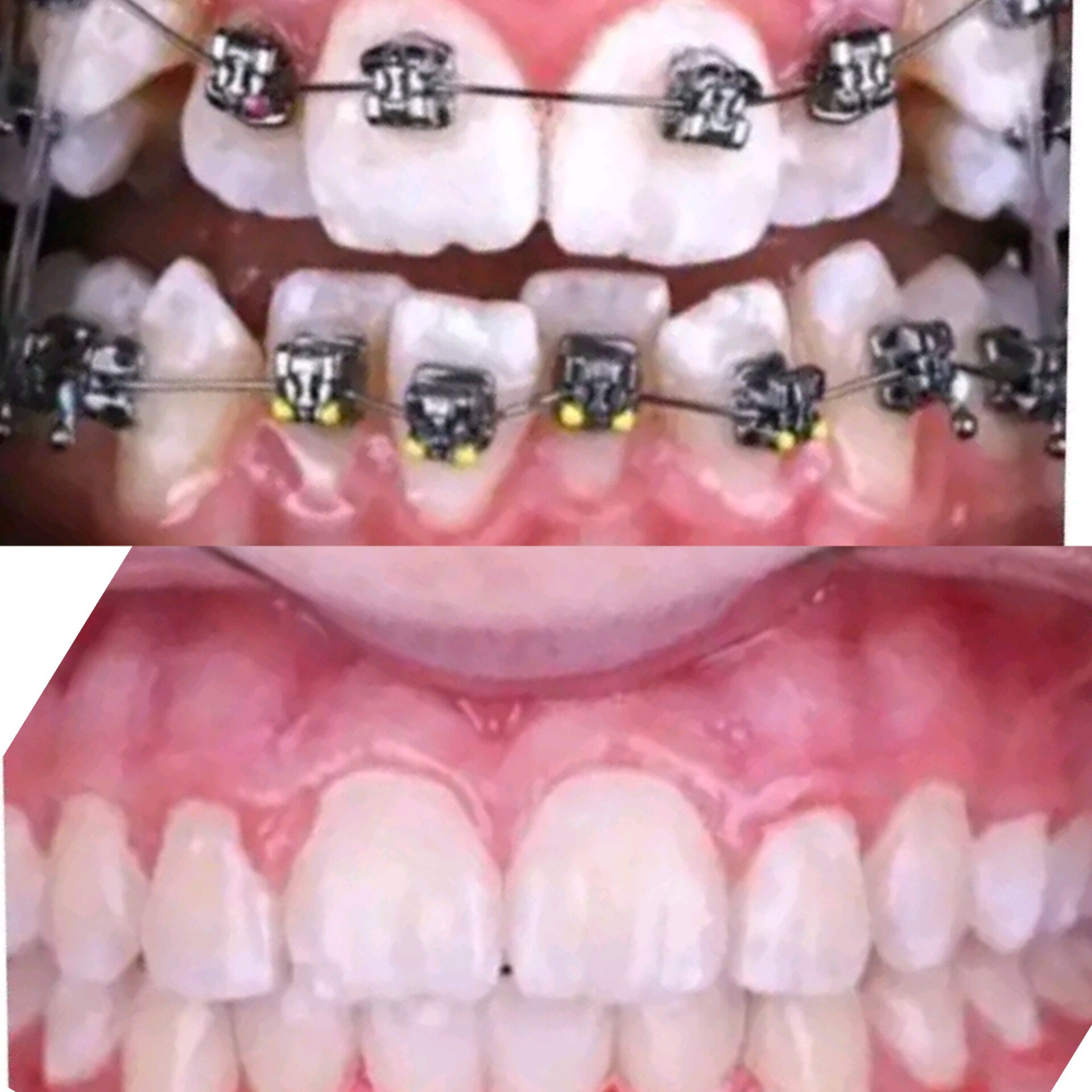 dental Solutions kampala (drteethkampala) / Twitter