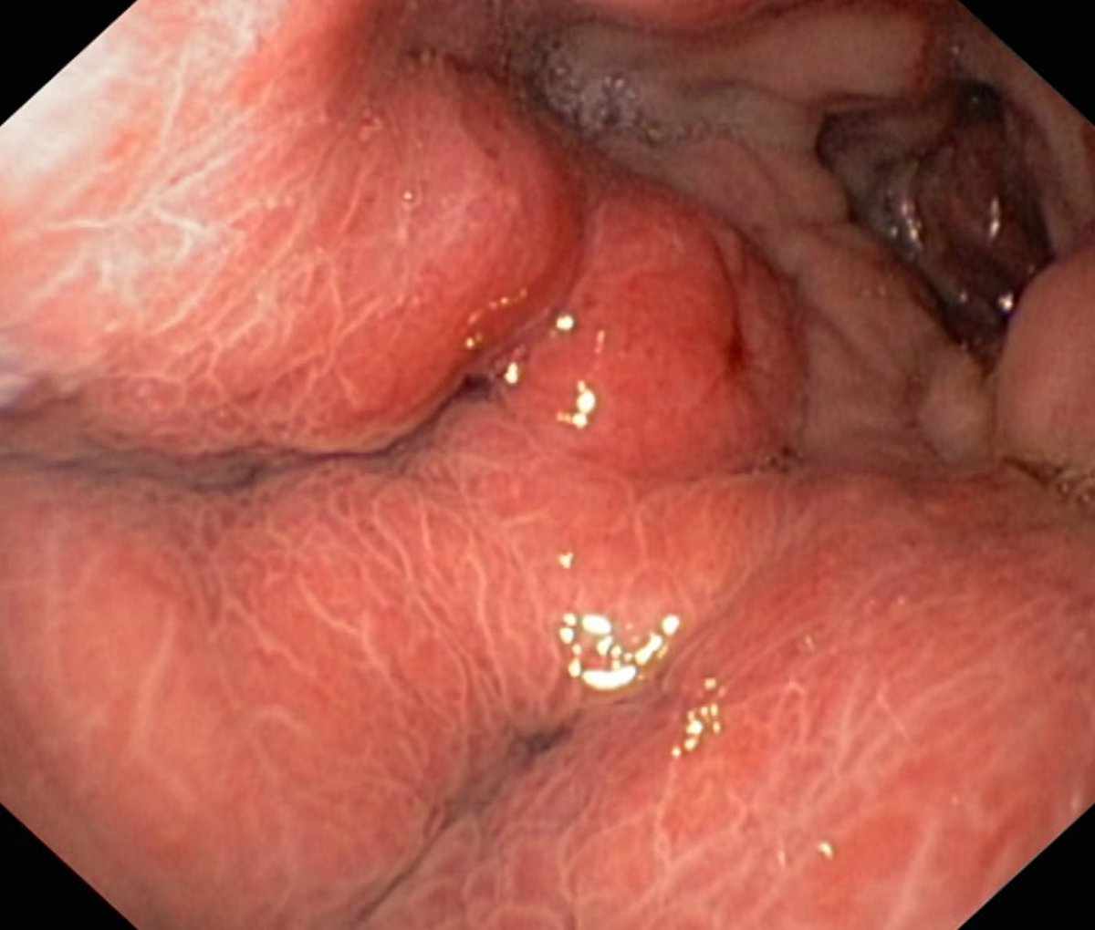 EndoCollab™ | GI Endoscopy Community tweet media