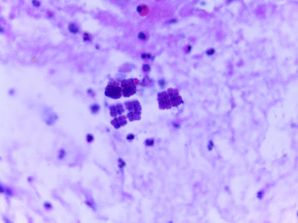 Víctor Vivó Serrano tweet media