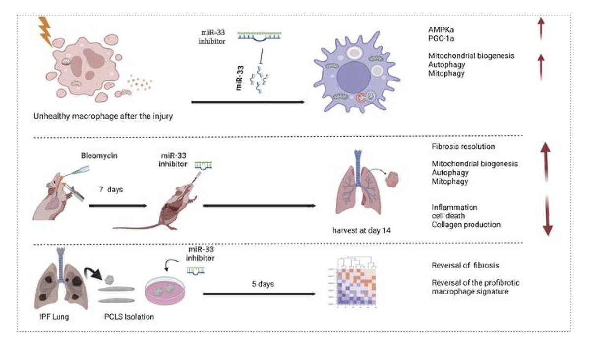 1/n Our first #CurePF paper for 2023 is OUT! A novel role in Pulmonary Fibrosis for miR-33, a key regulator of macrophage immuno-metabolic response &  mitochondrial function, providing evidence that inhibition may be antifibrotic 
#miR33PFPaper
doi.org/10.1172/jci.in…