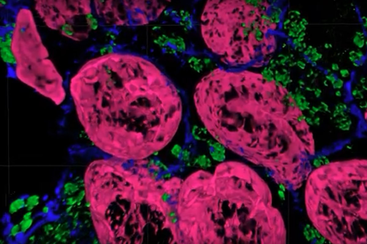 Unprecedented views of the interior of cells and nanoscale structures are now possible thanks to innovations in expansion microscopy by <a href="/CmuScience/">CMU Mellon College of Science</a>'s Yongxin (Leon) Zhao. The novel "Magnify" protocol uses a new hydrogel formula invented by Zhao's team. cmu.is/zhao-magnify