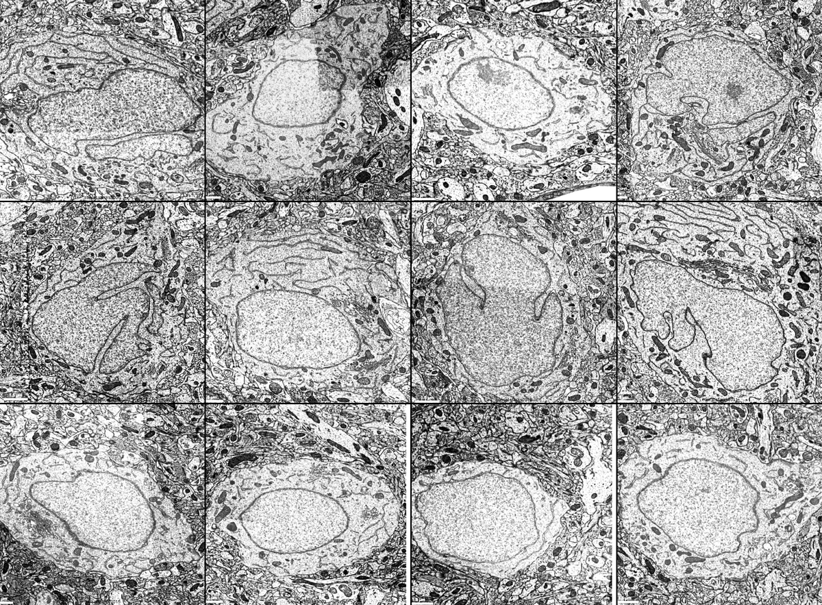 mcammer1's tweet image. #EM_Monday again! These are randomly selected cell bodies, close to the nucleus periphery, of 6 inhibitory and 6 excitatory neurons from layer 2/3 of microns-explorer.com. Can you tell which are which?