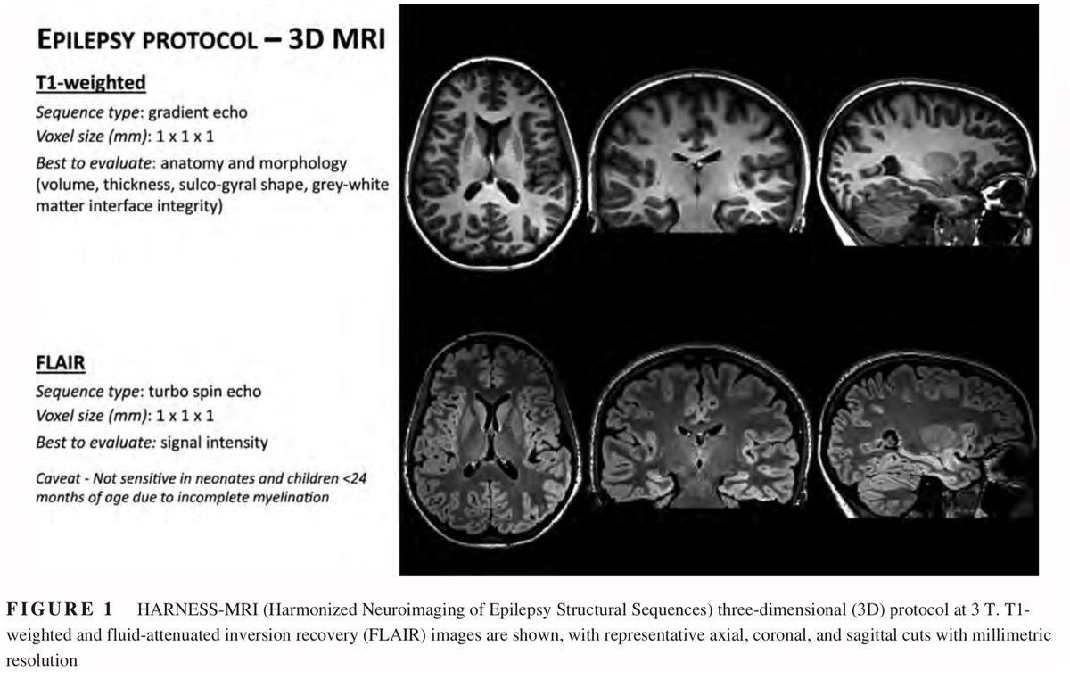 JordiRoldanB's tweet photo. #OnePediNeuroimaging (and adult) 🌏

#neurotools 

In epilepsy, to minimize -MRI when they´re really +MRI, let ´ s adapt our own protocols to the best standar: HARNESS-MRI from the ILAE. 2019

https://t.co/ILP7yMvghi https://t.co/8cXpB3qWYm