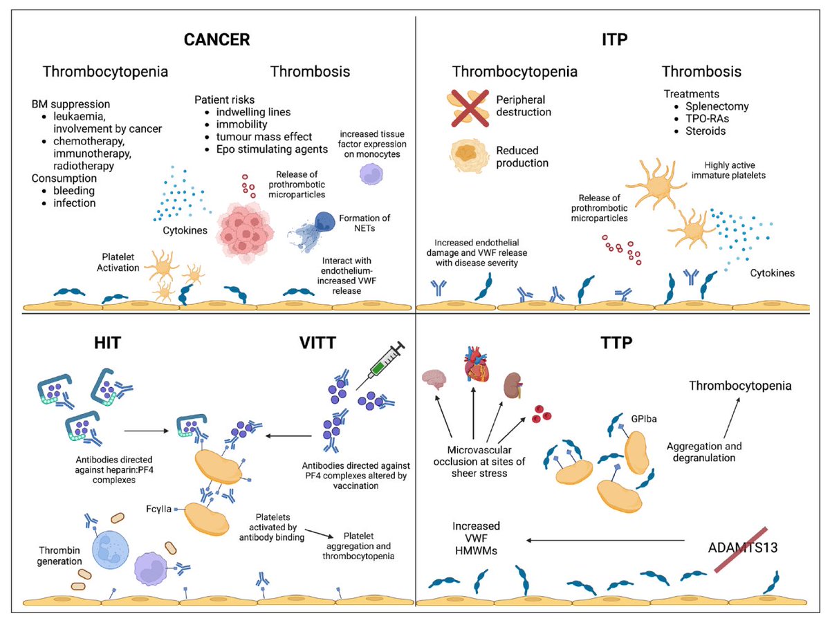 RCPEdin's tweet photo. How do you manage anticoagulation in thrombocytopenia? What do you do with recurrent thrombosis? Or when do you resume anticoagulation after gastrointestinal/intracranial haemorrhage?
Read a review here: https://t.co/rbVmlx1i8B
#haematology #thrombosis #Medtwitter #JRCPEchat https://t.co/Yrs8SWNdt3