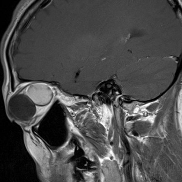 brown-hospital-medicine-on-twitter-a-45-year-old-female-presented