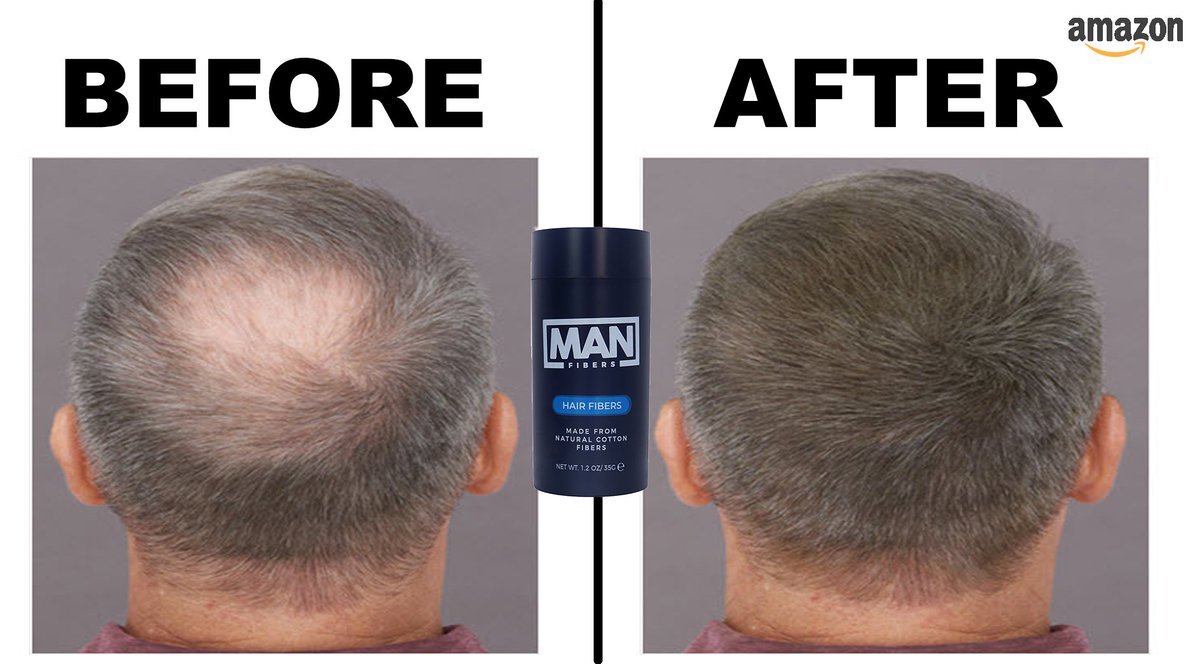 Feeling frustrated with hair loss? Manfibers can give you the coverage you need to feel confident and stylish. Try it out today! #hairloss #manfibers #Toppik #Caboki #Nanogen #Hairlab #Kerafiber #DermMatch #Mrjamiestevens #Thickfiber