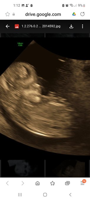 13 week scan today my little baby was so cute playing with us waving kicking.  Very healthy my pregnancy