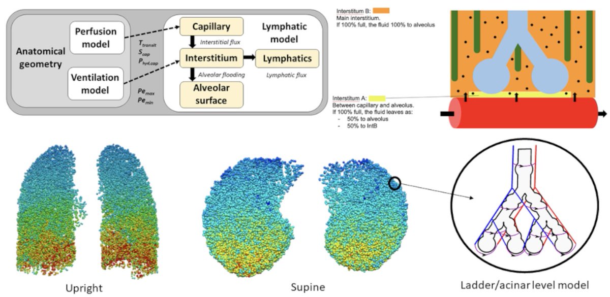 AJP-Heart and Circ (@ajpheartcirc) on Twitter photo #ArticlesInPress: An in silico approach to understanding the interaction between #cardiovascular and #pulmonary lymphatic dysfunction
(Ashworth et al.)
ow.ly/ua8Y50MnLvj
@alysrclark <a href="/AucklandUni/">University of Auckland | Waipapa Taumata Rau</a>
#Pulmonary #Lymphatics #ArticlesInPress: An in silico approach to understanding the interaction between #cardiovascular and #pulmonary lymphatic dysfunction
(Ashworth et al.)
ow.ly/ua8Y50MnLvj
@alysrclark <a href="/AucklandUni/">University of Auckland | Waipapa Taumata Rau</a>
#Pulmonary #Lymphatics