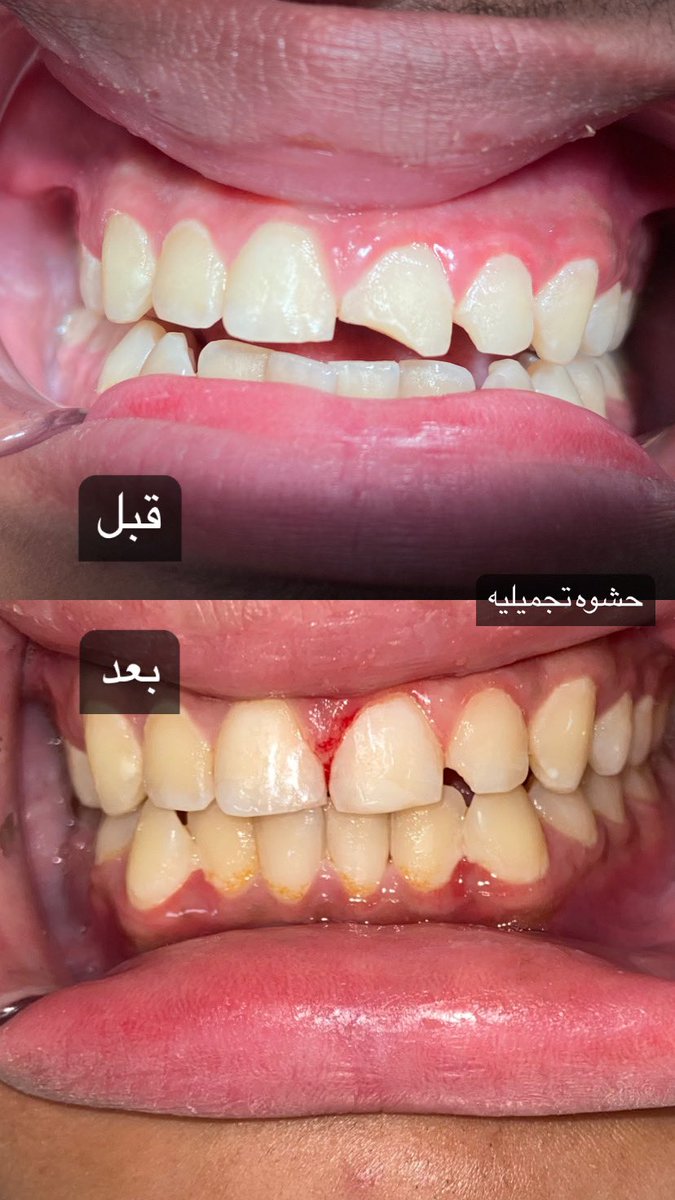 Dr.Raed Alasmari tweet media