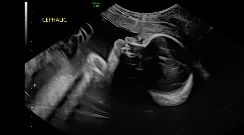 pixiepinayco's tweet image. Put my shop on a small mental health break… this is why! The 3rd trimester is kicking my ass 🥱.