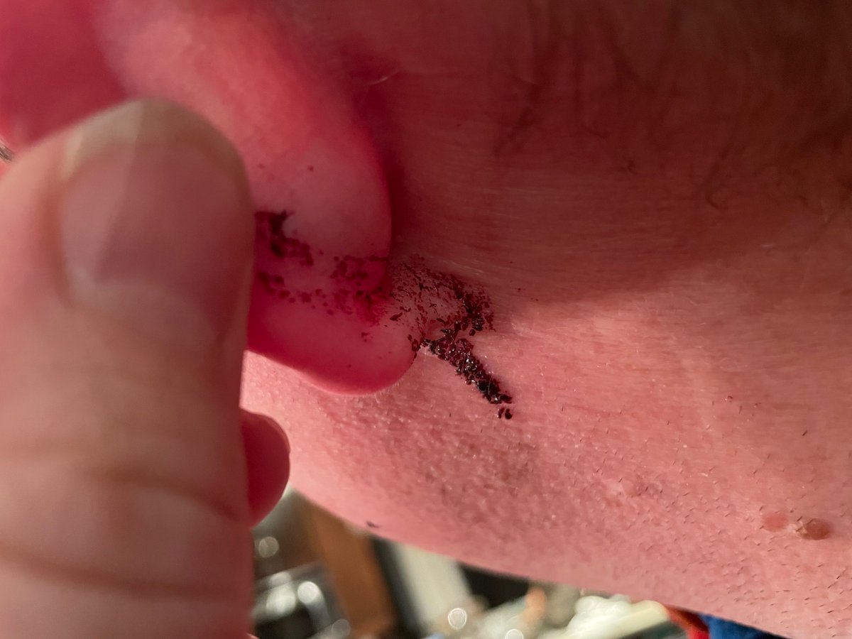 Joel Wood tweet media