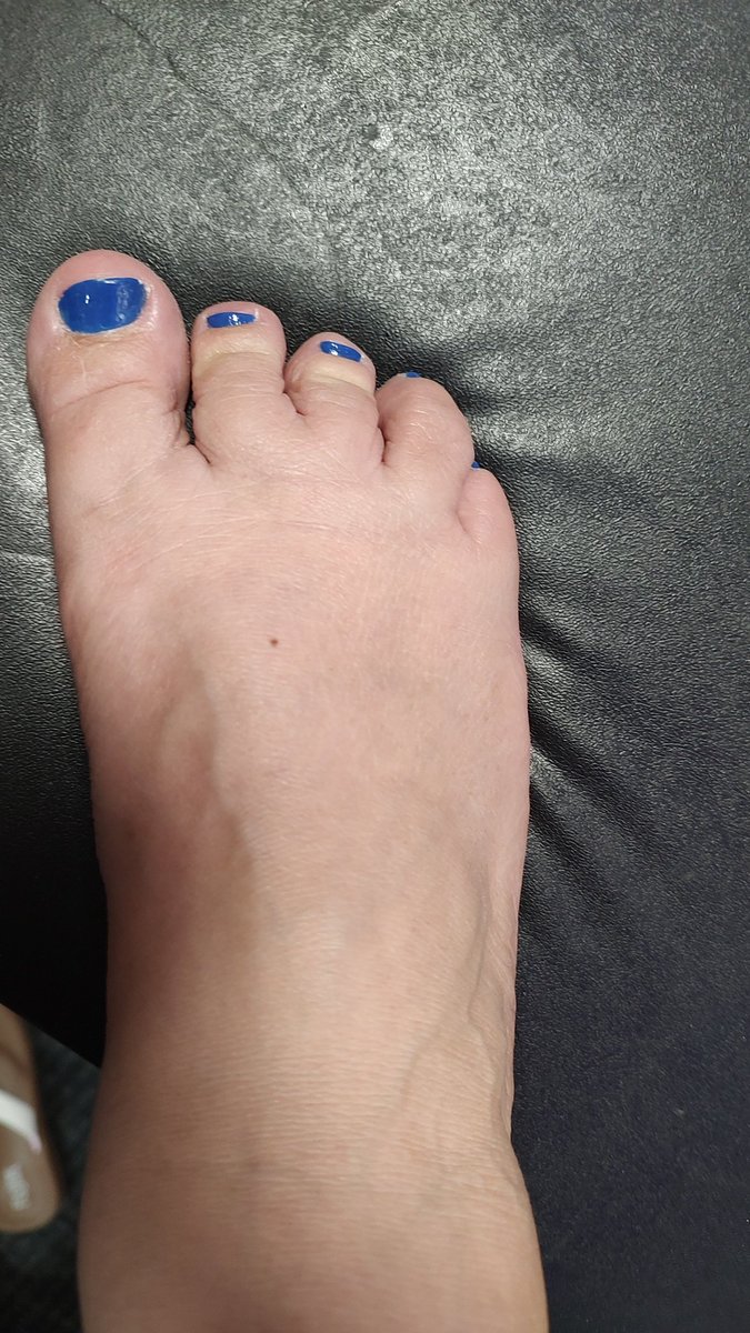 FootgoddessH's tweet photo. Come to Foot night to see my cute tiny toes size 9 foot. Soft and tiny toes
#trampling 
#footfetish
@NEFlafootevents https://t.co/dMOjZIxtL6